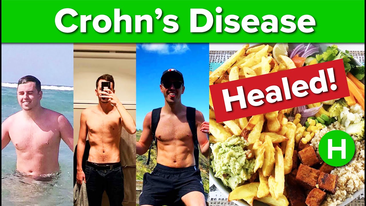 How to Heal Crohn's disease on a Plantbased diet (Testimonial) YouTube