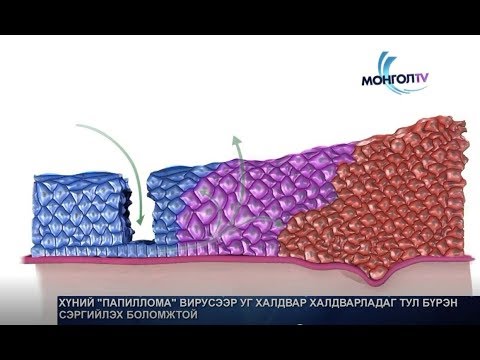 Видео: Муур дахь шээсний замын шилжилтийн эсийн хорт хавдар