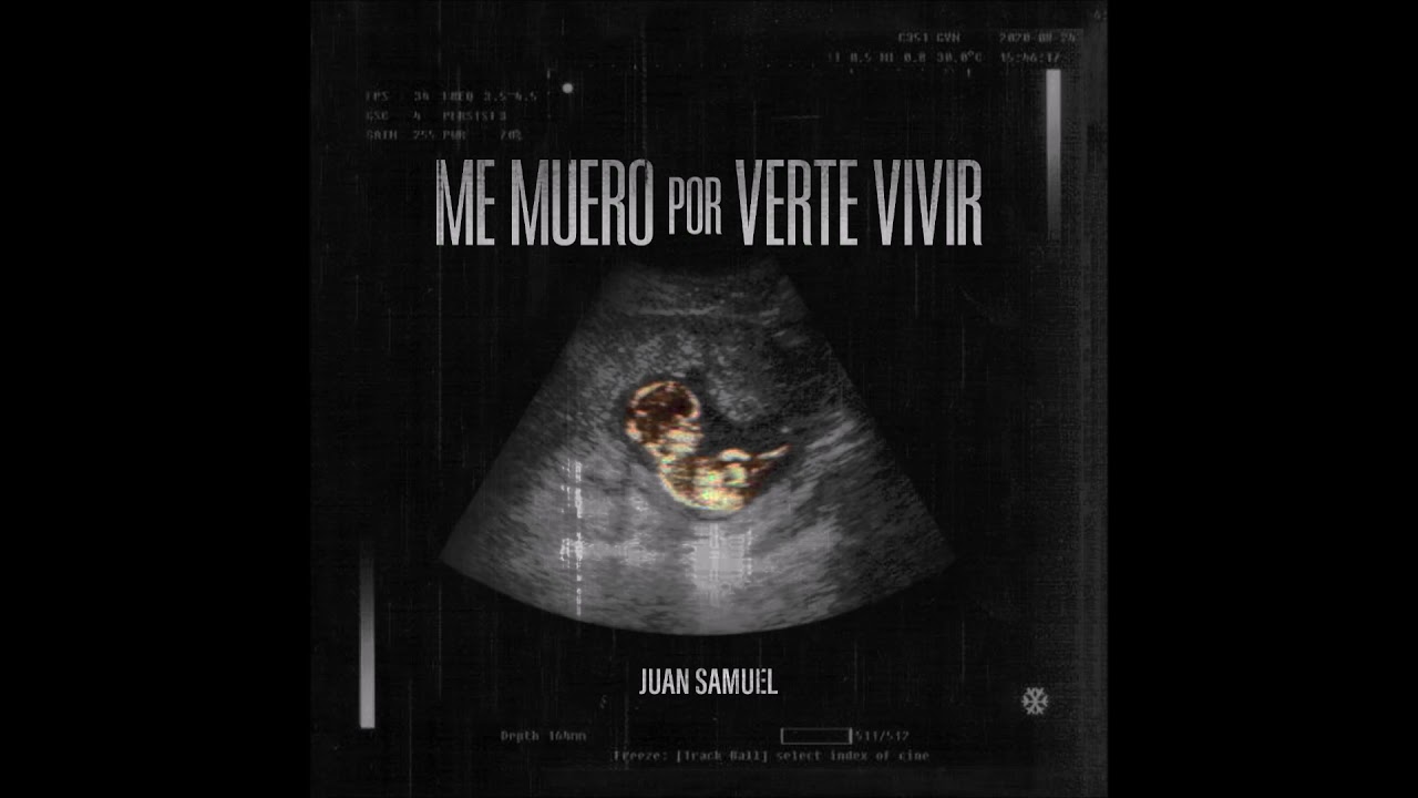 "Me Muero Por Verte Vivir" - Juan Samuel
