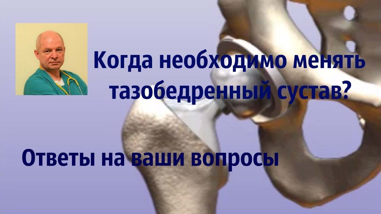 артроз тазобедренного сустава без операции Вам попробовать поискать