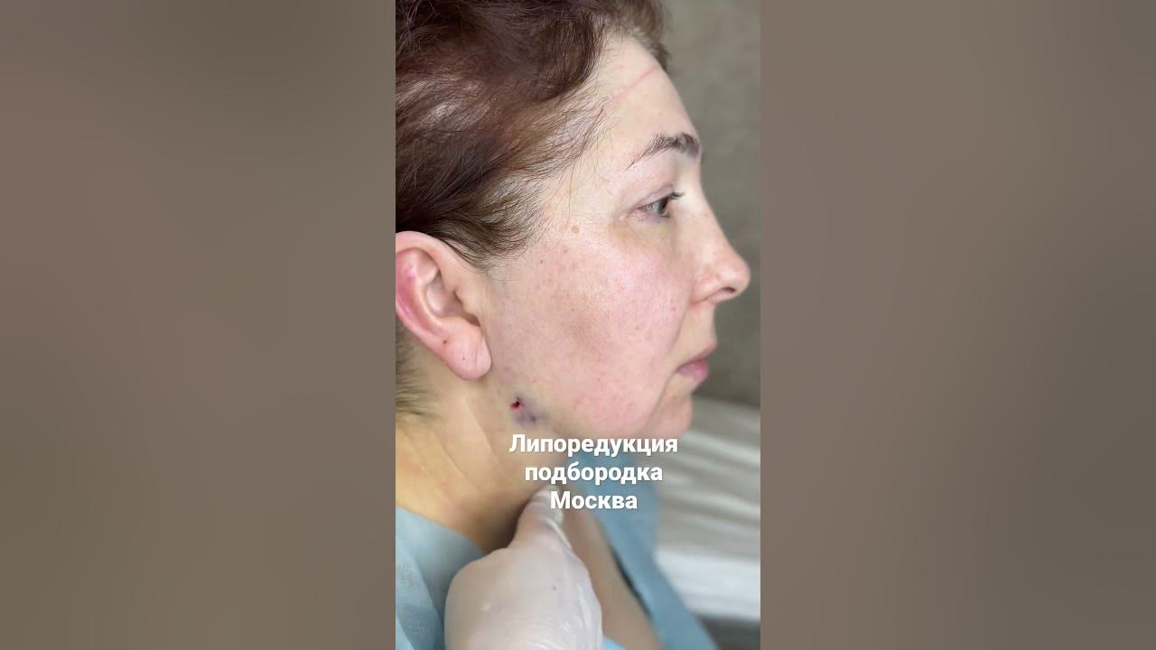 Откорректировать овал лица, сделать его визуально моложе, выровнять пропорции, и