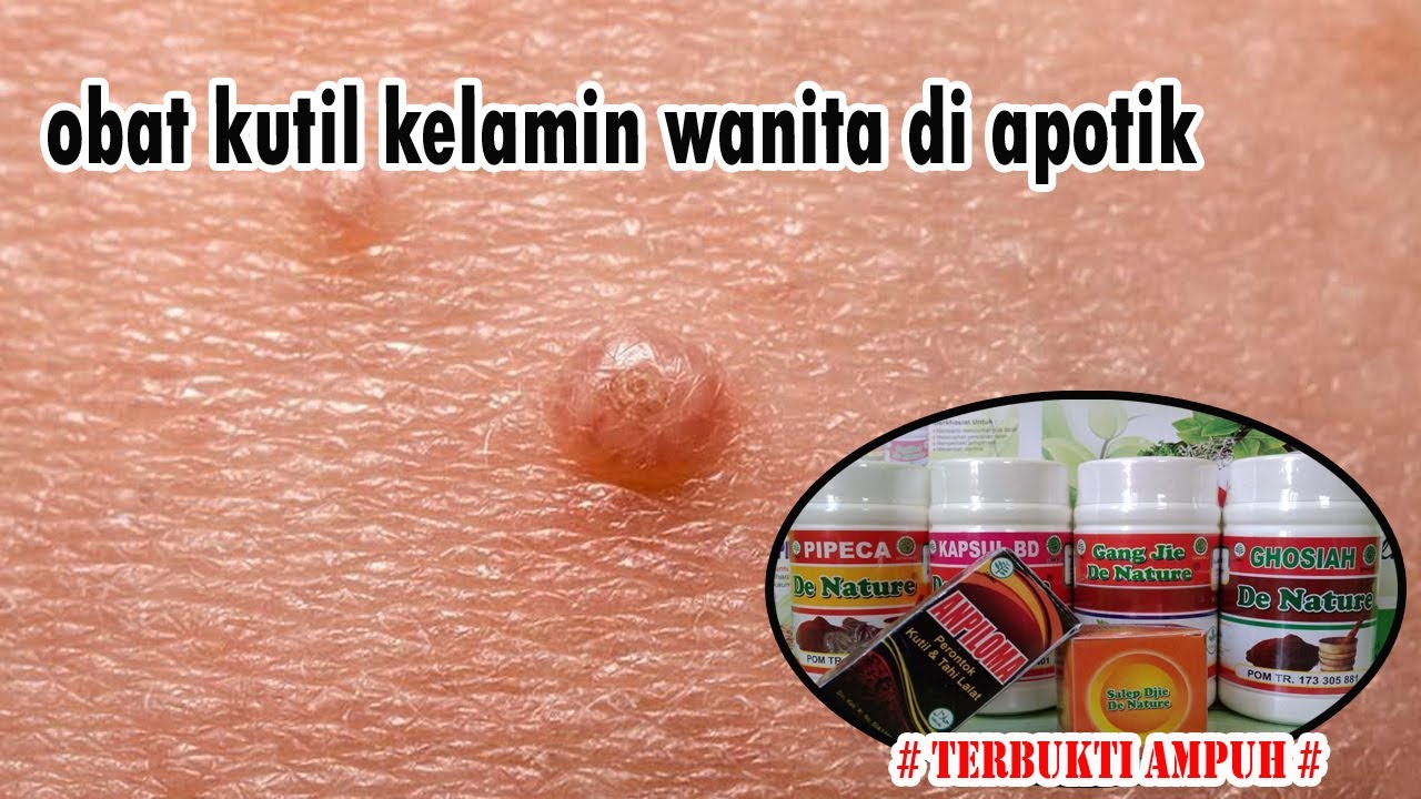 obat kutil kelamin wanita di apotik 
