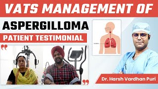 Patient Testimonal (VATS Management of Aspergilloma) | Dr. Harsh Vardhan Puri