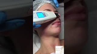 Pulizia del viso con ultrasuoni