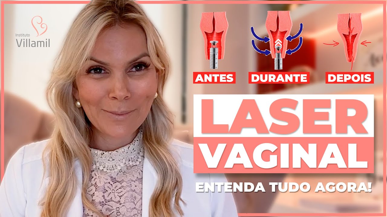 Laser Vaginal Saiba Tudo Sobre O Rejuvenescimento Ntimo Dra