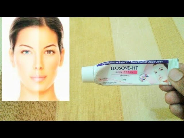 Best Skin Lightening Cream Elosone Ht Cream By Unbeatable Products By Rahul Dandagawal