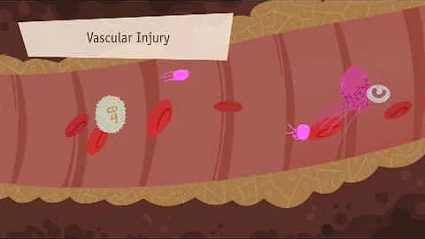 Hemostasis, Coagulation and Fibrinolisis