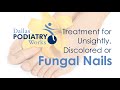 Fungal Toenails