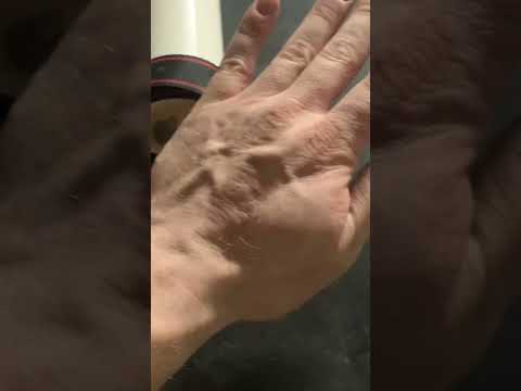 How I Made My Hands Thicker