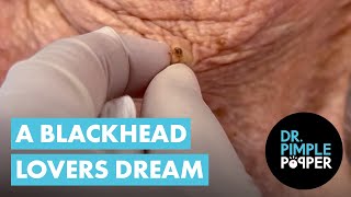 A Blackhead Lovers Dream screenshot 1