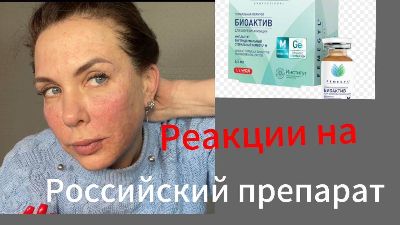 Биоактив. препарат для биоревитализации. Реакция моей кожи на препарат.