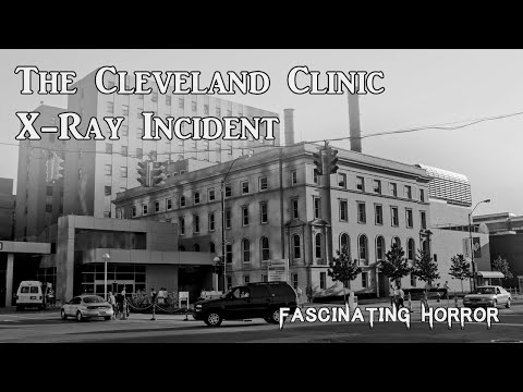 The Cleveland Clinic X-Ray Incident | A Short Documentary | Fascinating Horror