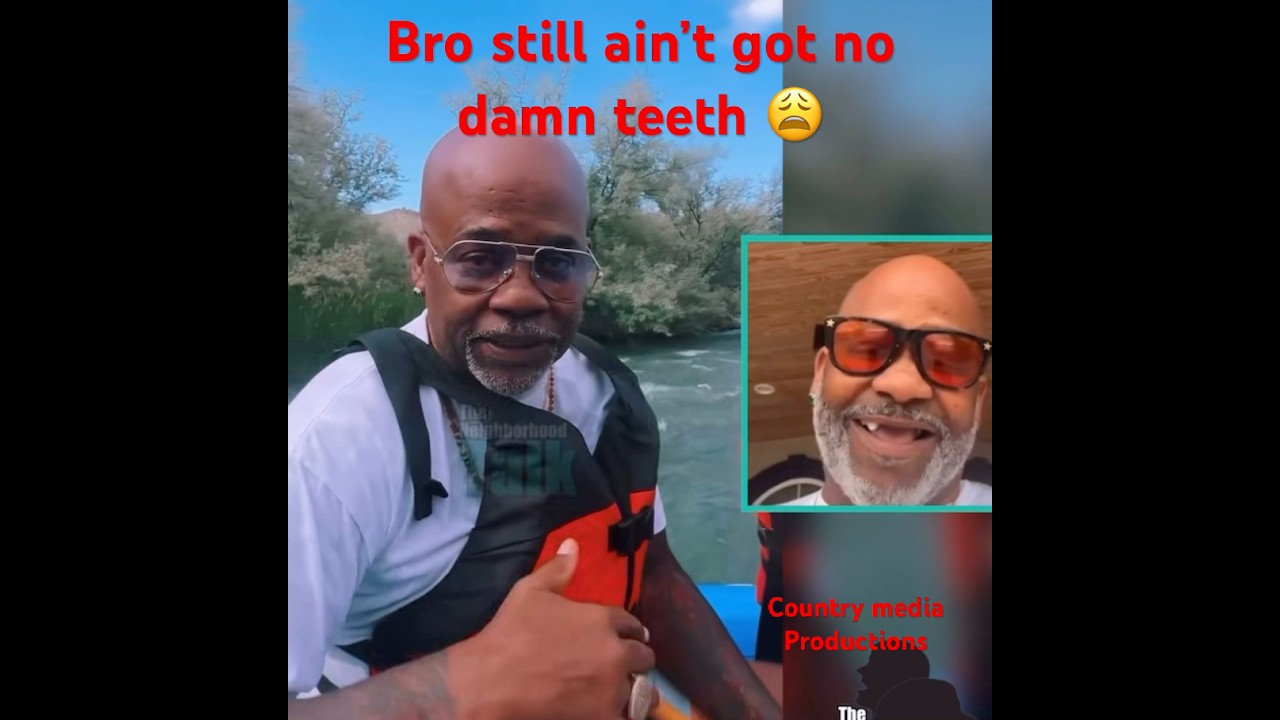 Dame Dash Still Has No Teeth 🦷 