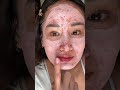 Sorted out the clogged pore before boat day so I can take cute pics hehe #cloggedpores