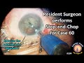 Surgeon in training performs cataract surgery 60