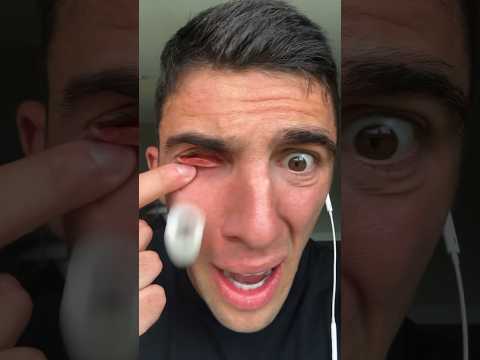 MY EYEBALL PUNCHED