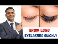 Grow long, Healthy Eyelashes Quickly | How to grow thick and long eyelashes Naturally