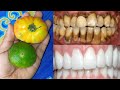 Yellow teeth to white teeth naturally​ in 1 hour​ with tomato at home