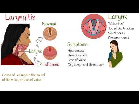 Video: Hoe weet u of u laryngitis heeft (met afbeeldingen)