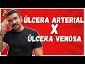 🔴Aprenda a Diferença entre a Ulcera Venosa e Ulcera Arterial I Aula COMPLETA