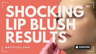 Discover The Lip Blushing Healing Process Step-By-Step Visuals