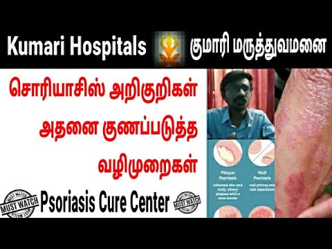 Psoriasis siddha orvostudomány tamilo