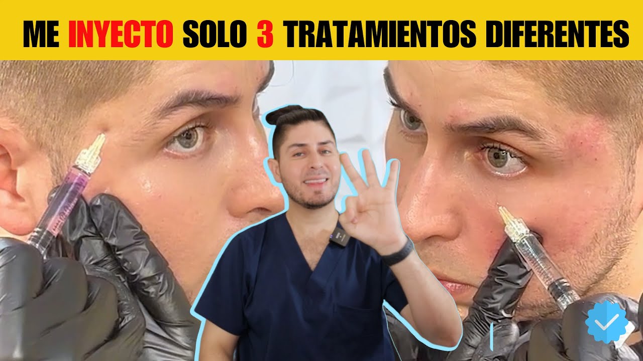 Radiofrecuencia fraccionada, ¿cómo se hace? | UNBOXING