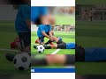 ACL Injury | Odd Appearance on One Side of your Knee | Sports Injury | Part 2 #shorts