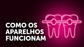 Como Funcionam os Aparelhos Ortodônticos e Por Que Seu Uso É Tão Prolongado