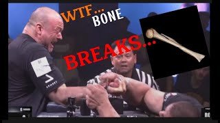 WORST Arm Wrestling Injuries    #worst #injuries #broken #snap