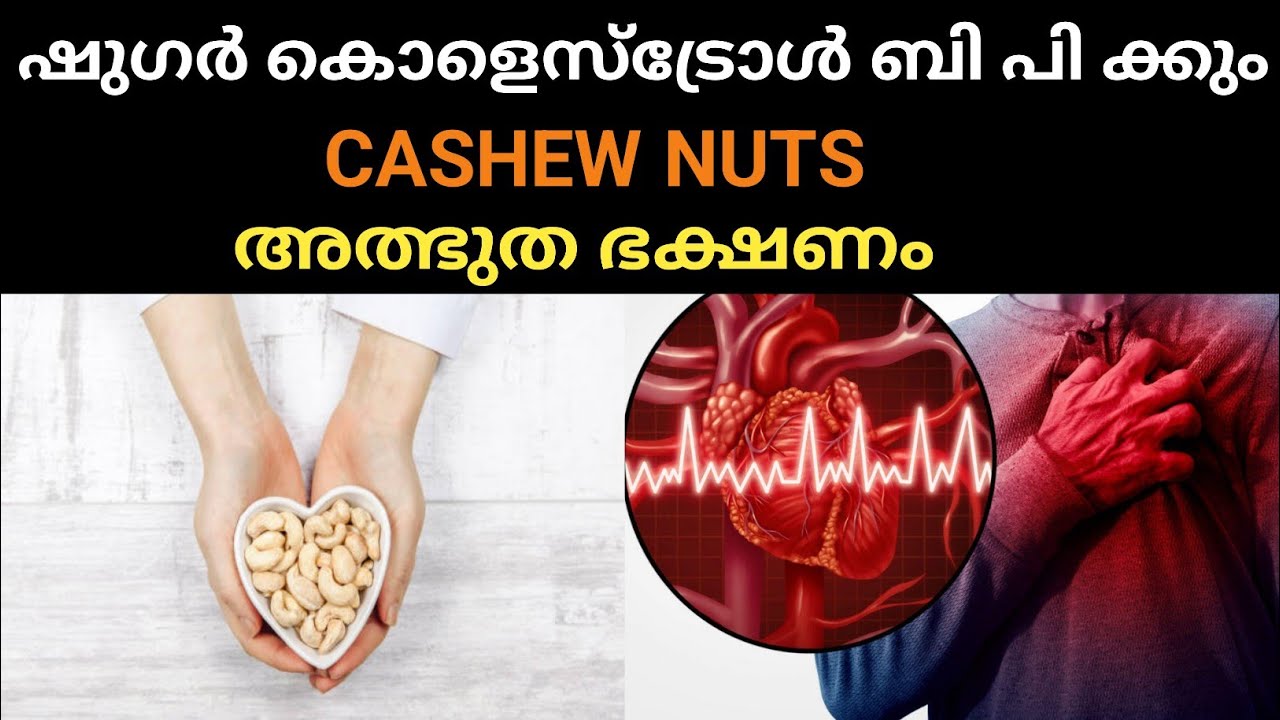 Nutrition malayalam ! Cashews Malayalam ഷുഗർ കൊളെസ്ട്രോൾ ബി പിയുള്ളവ