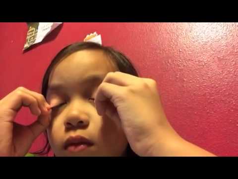 Flip Eyelid Inside Out : Lloyd's Flipped Eyelids 2 - YouTube / Eye with