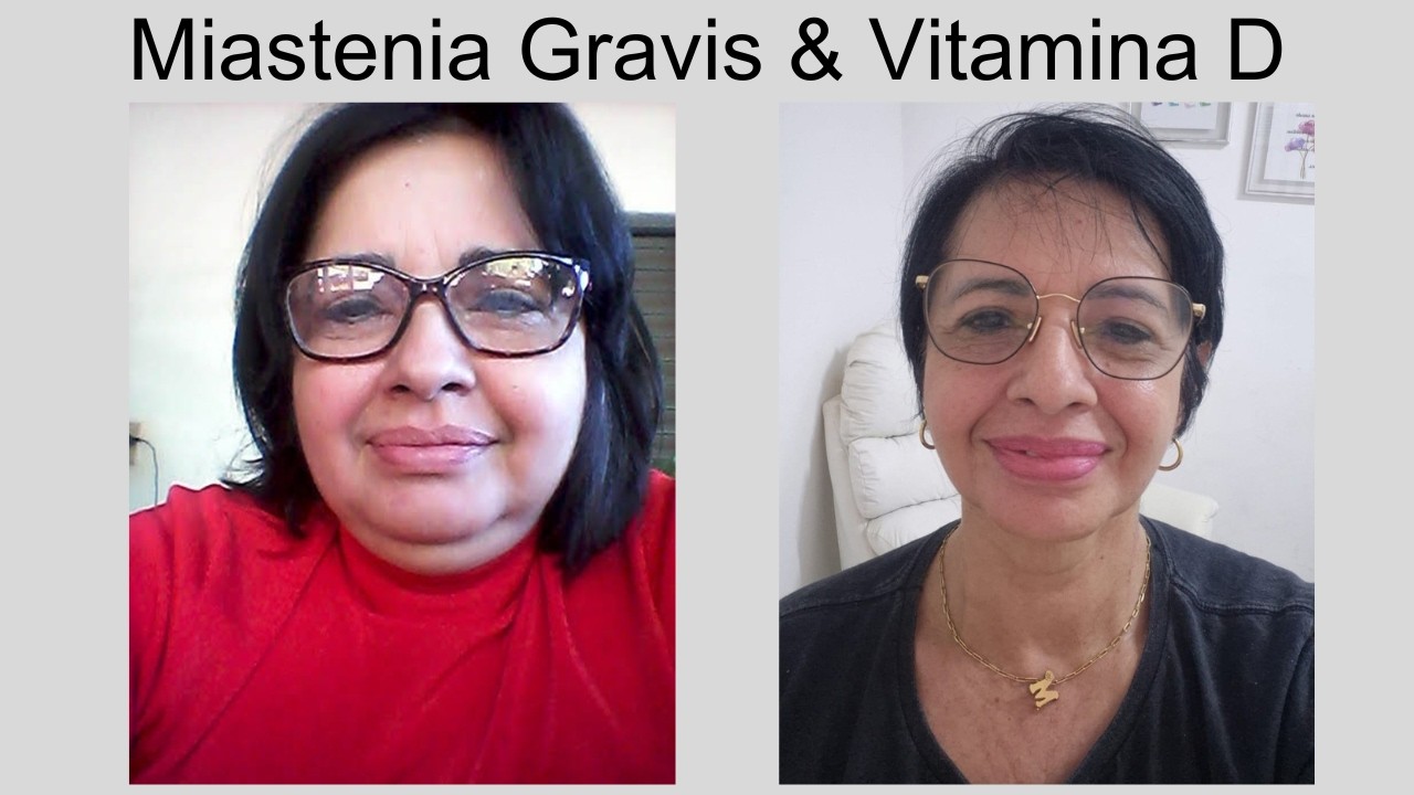 Rosana - Miastenia Gravis #1167