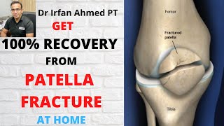 Complete Rehabilitation and Best Exercises for Patella fracture at home | 100% Recovery |Urdu/Hindi