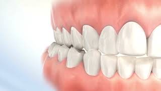 Basic Orthodontic Terms