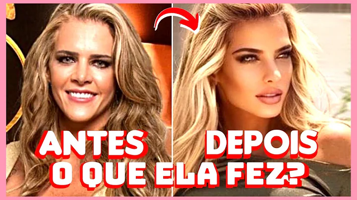 Antes e depois de Denise Rocha | Noticia dos famosos