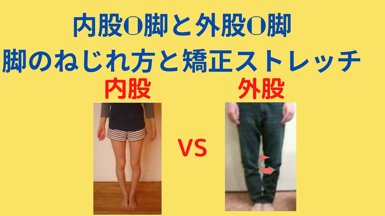 内股o脚と外股o脚の脚のねじれ方と矯正ストレッチ Youtube 内股o脚と外股o脚の脚のねじれ方と矯正ストレッチ Youtube