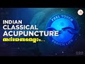 Indian classical acupuncture  timepass with abhinav