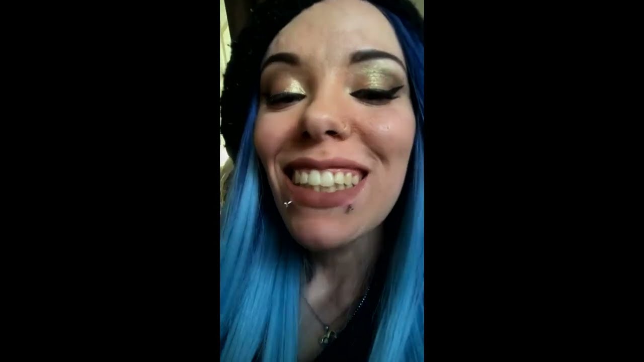 Customer Reviews VieBeauti Teeth Whitening Kit YouTube