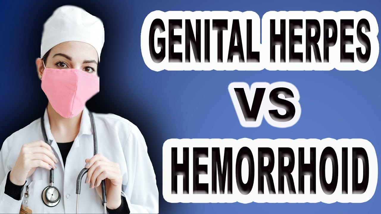Genital Herpes Vs Hemorrhoids YouTube