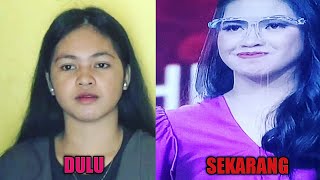BERUBAH...Bandingkan Foto Dulu Rasdiani Setelah Tampil di LIDA 2021