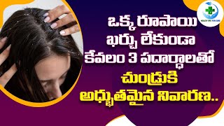 Amazing cure for dandruff with just 3 ingredients. | Dandruff Treatment | Health Tips