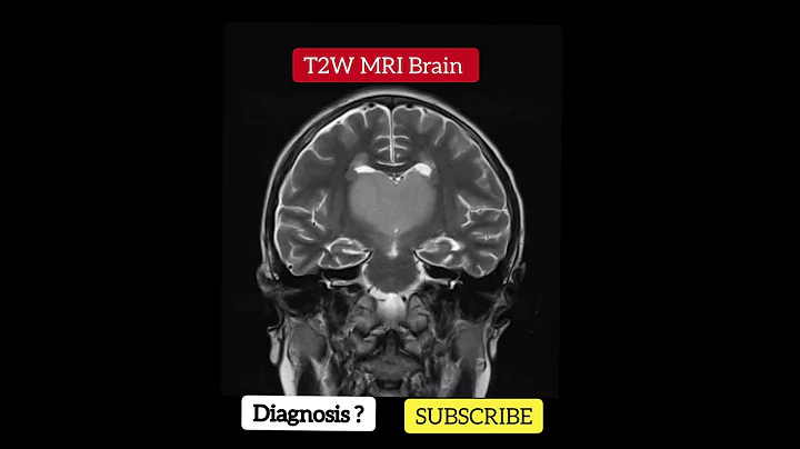 Diagnosis ? T2W MRI  -  Practical Case - Radiology