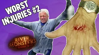 The WORST Injuries! (Part 2) | COMPILATION | River Monsters