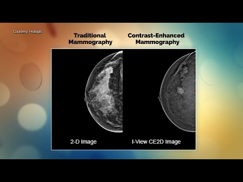 Contrast enhanced mammography, Dr. Karen Oh