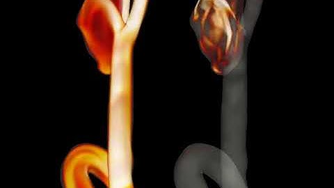 Visual isolation of cerebral aneurysm flow instabilities