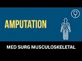 Amputation - Nursing Lecture - Chapter 37