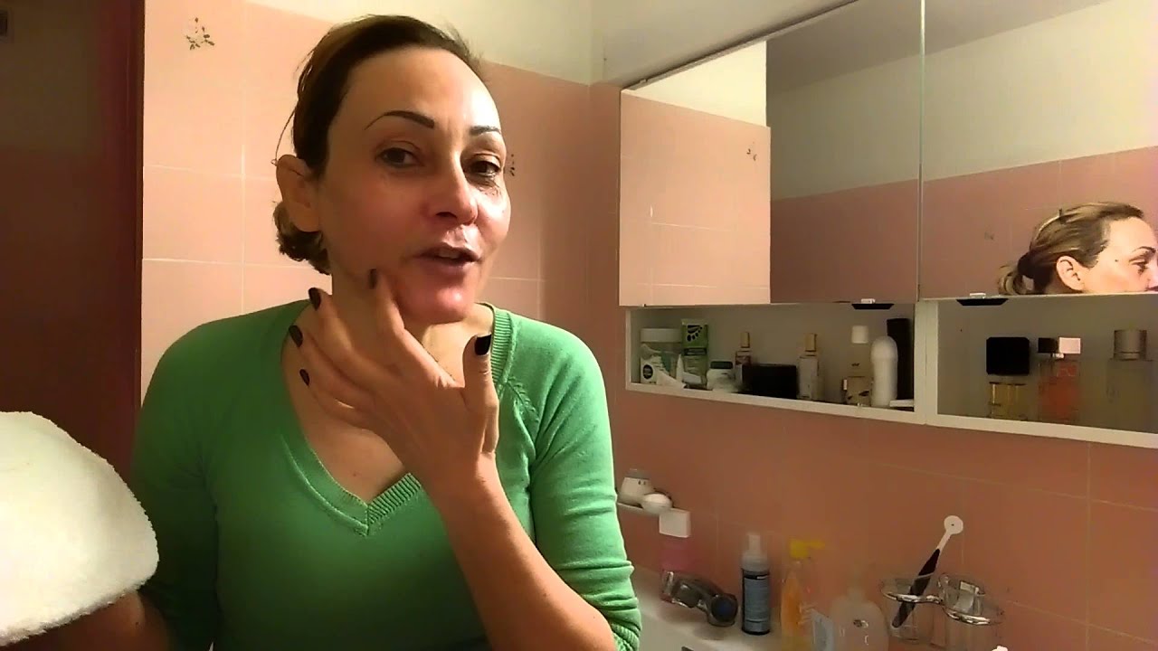 Cuidados com a pele depois do acido. parte 1.