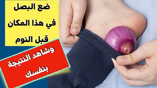 البصل -  ماذا سيحدث اذا وضعت قطعة من البصل في جوربك اثناء النوم - مالاتعرفه عن فوائد البصل ???