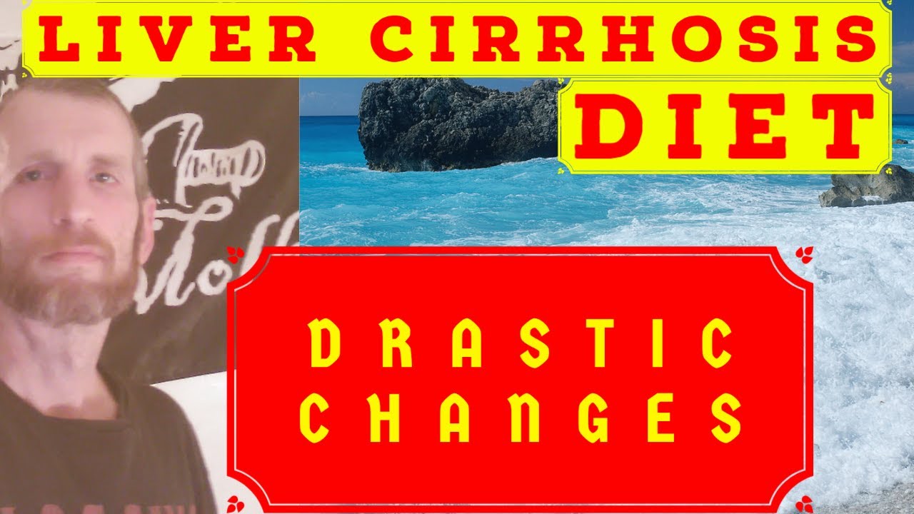 Liver Cirrhosis Diet and Exercise DRASTIC CHANGES - YouTube